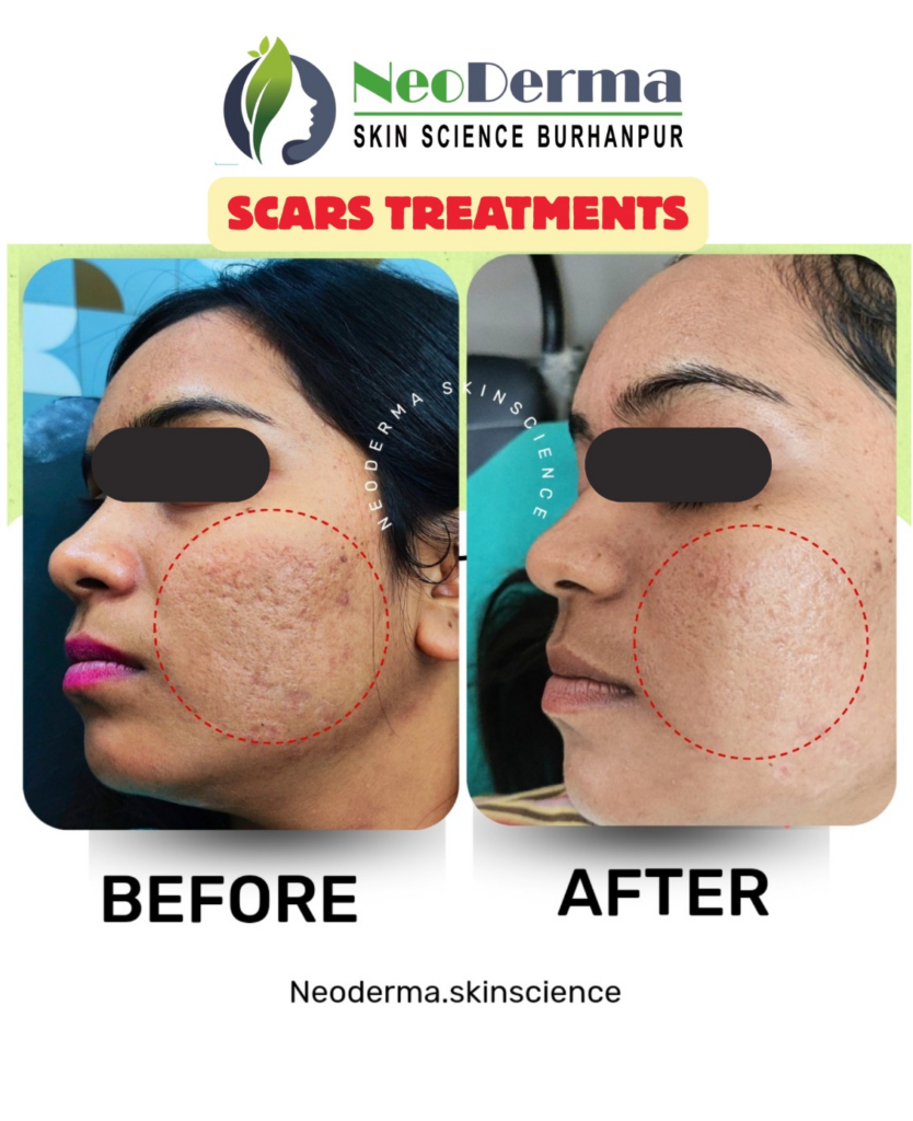 Before_After Image_123