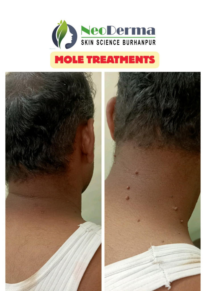 Before_After Image_4