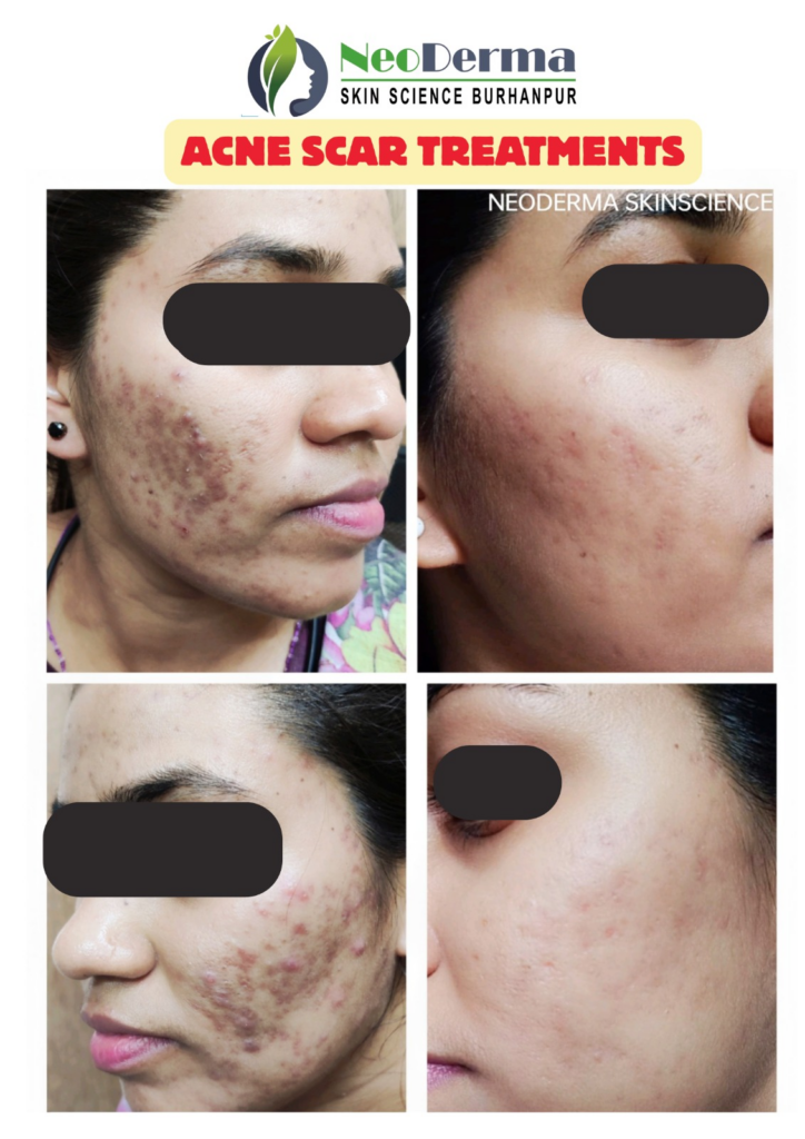 Before_After Image_44