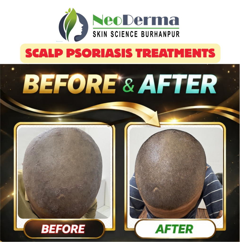 Before_After Image_12